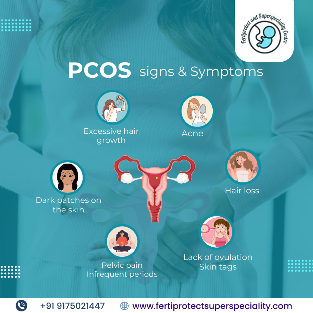 PCOS treatment in Pune