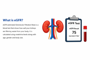 Illustration explaining eGFR test with kidney diagram and blood test report showing kidney function measurement.