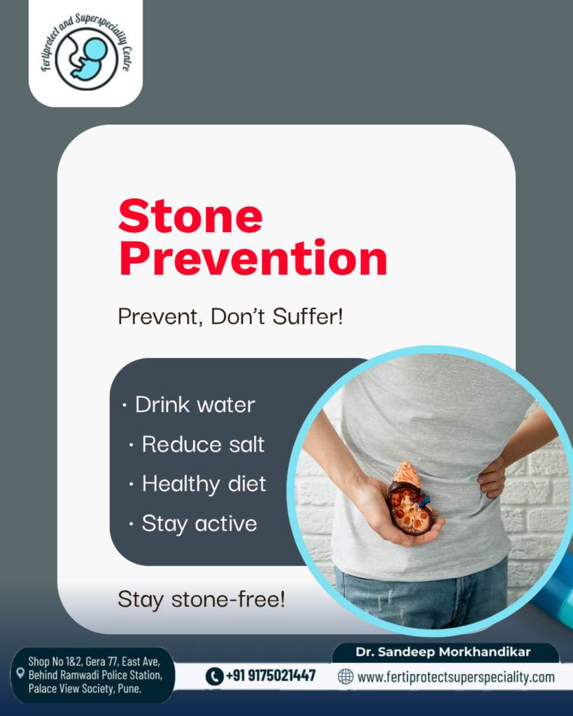 Kidney Stone Prevention: Simple Steps to Stay Stone-Free