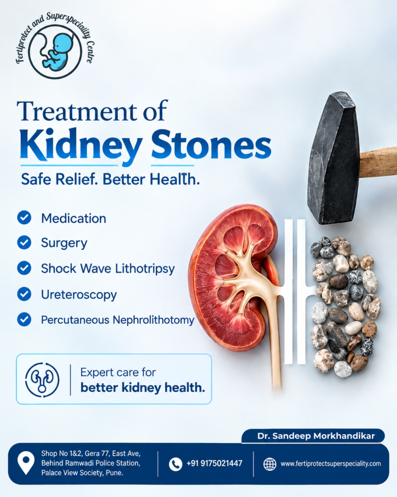 Kidney stone treatment options
